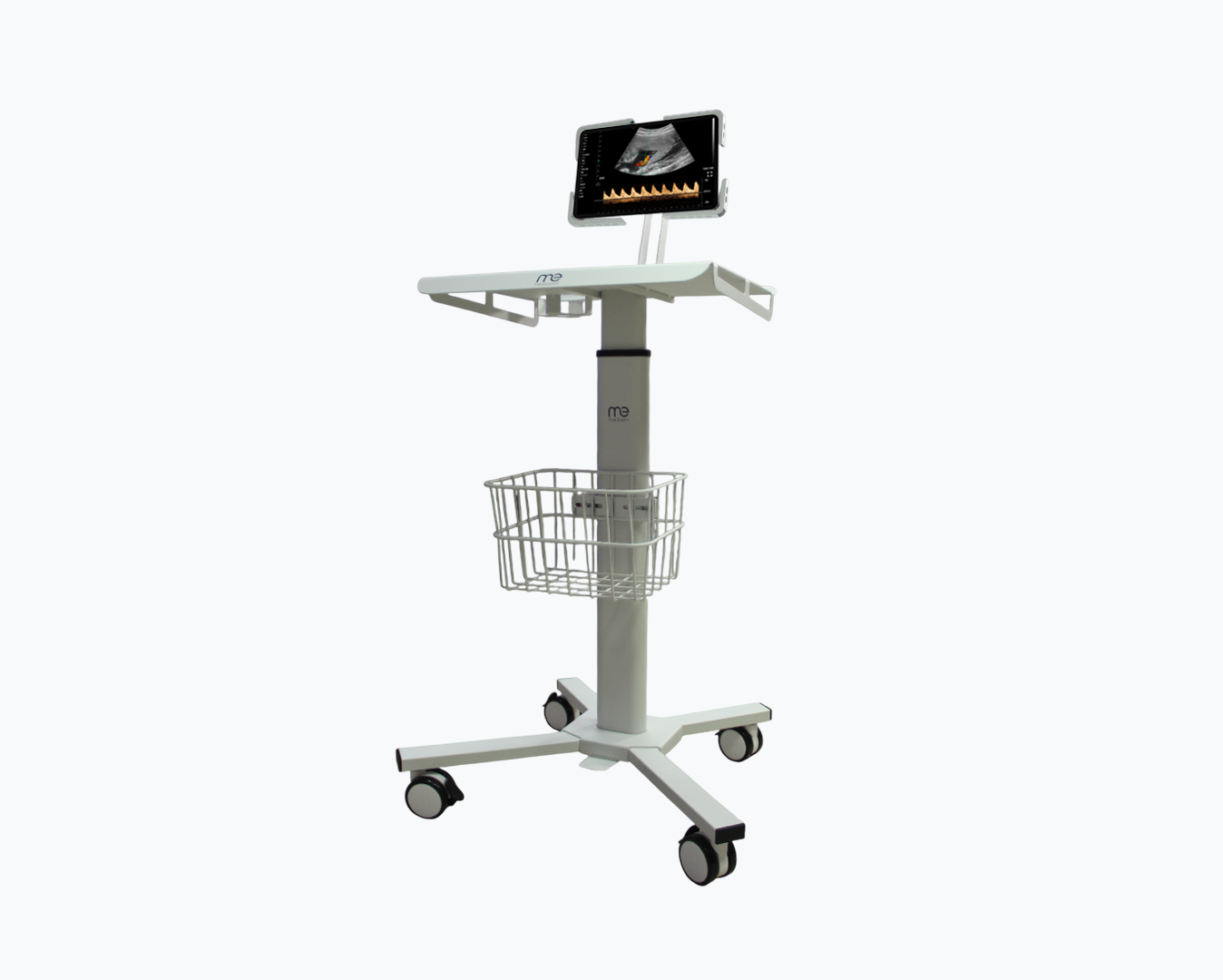SonoEase Trolley